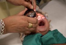 Al-Shifa Trust warns screening gaps raise blindness risk for premature babies Al-Shifa Trust warns screening gaps raise blindness risk for premature babies