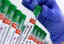 Mpox update: 25 confirmed cases, 9 deaths reported in Sindh Mpox update: 25 confirmed cases, 9 deaths reported in Sindh