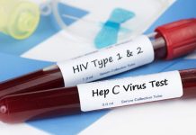 Govt makes HIV, Hepatitis B & C screening mandatory Govt makes HIV, Hepatitis B & C screening mandatory